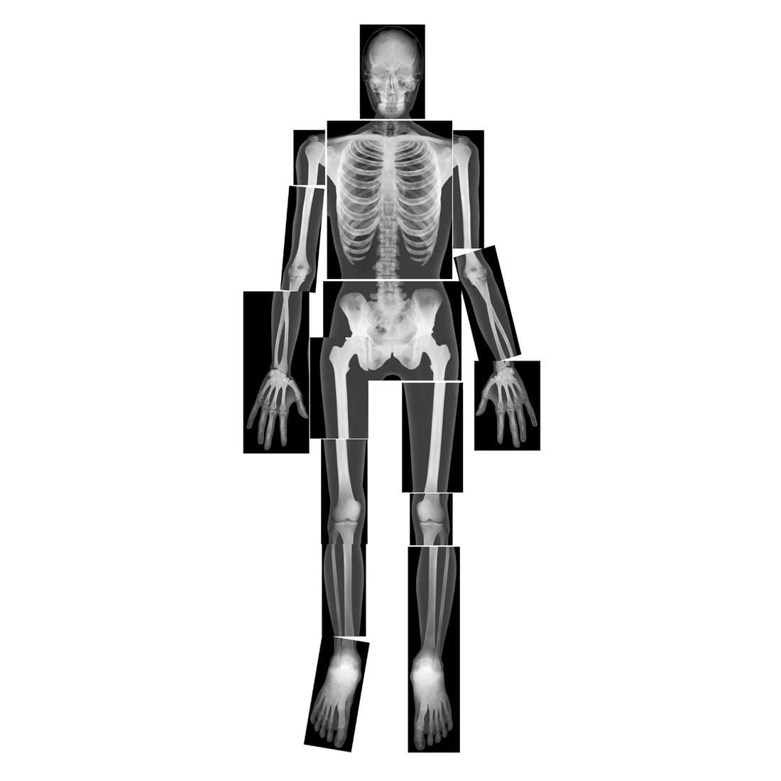 Roylco True-To-Life Human X-Rays